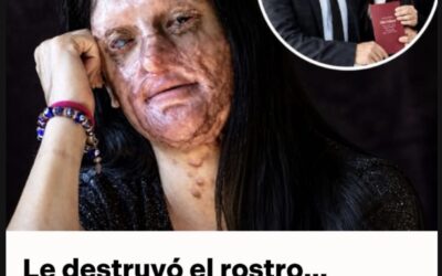 Le desfiguró el rostro con ácido y años después ella se casó con él: el caso que genera indignación y debate mundial
